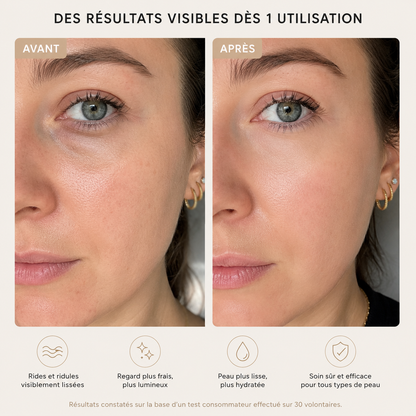 PATCHS POUR LES YEUX ANTI-RIDE ™